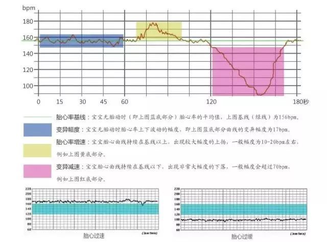 6d3c5430d1b948dfaca3a48e0c4736bb.jpeg 6d3c5430d1b948dfaca3a48e0c4736bb.jpeg